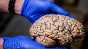 Uno zoom mostra il cervello umano come mai visto prima