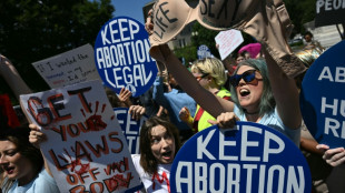 US abortion restrictions have unwanted knock-on effects: studies