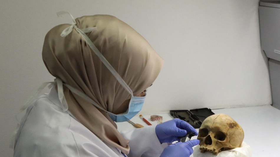 Segni di chirurgia dei tumori su un cranio di 4.000 anni fa