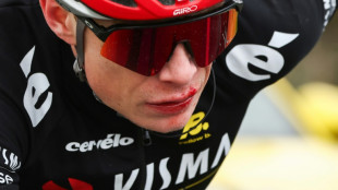 Paris-Nice: Vingegaard chute et repart avec la lèvre en sang
